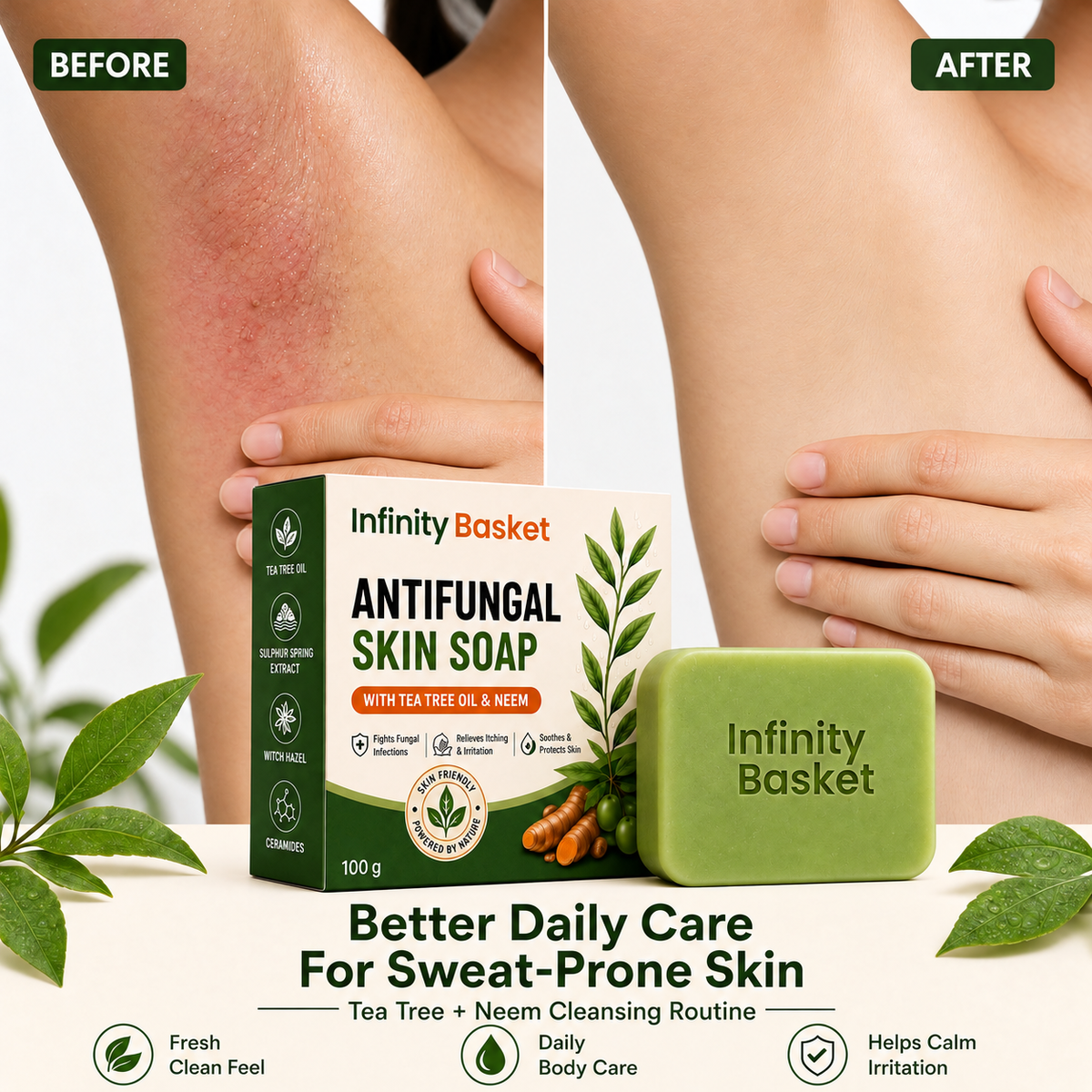 Antifungal Skin Soap – Infinity Basket India