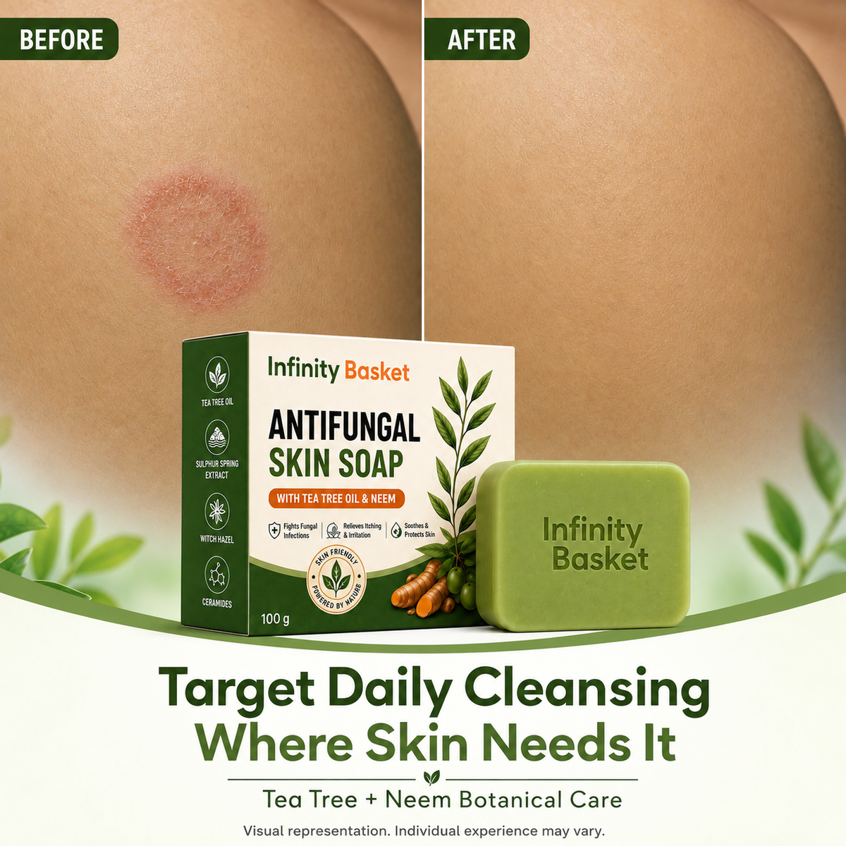 Antifungal Skin Soap