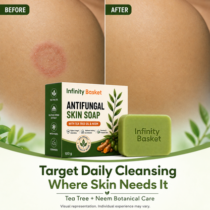 Antifungal Skin Soap