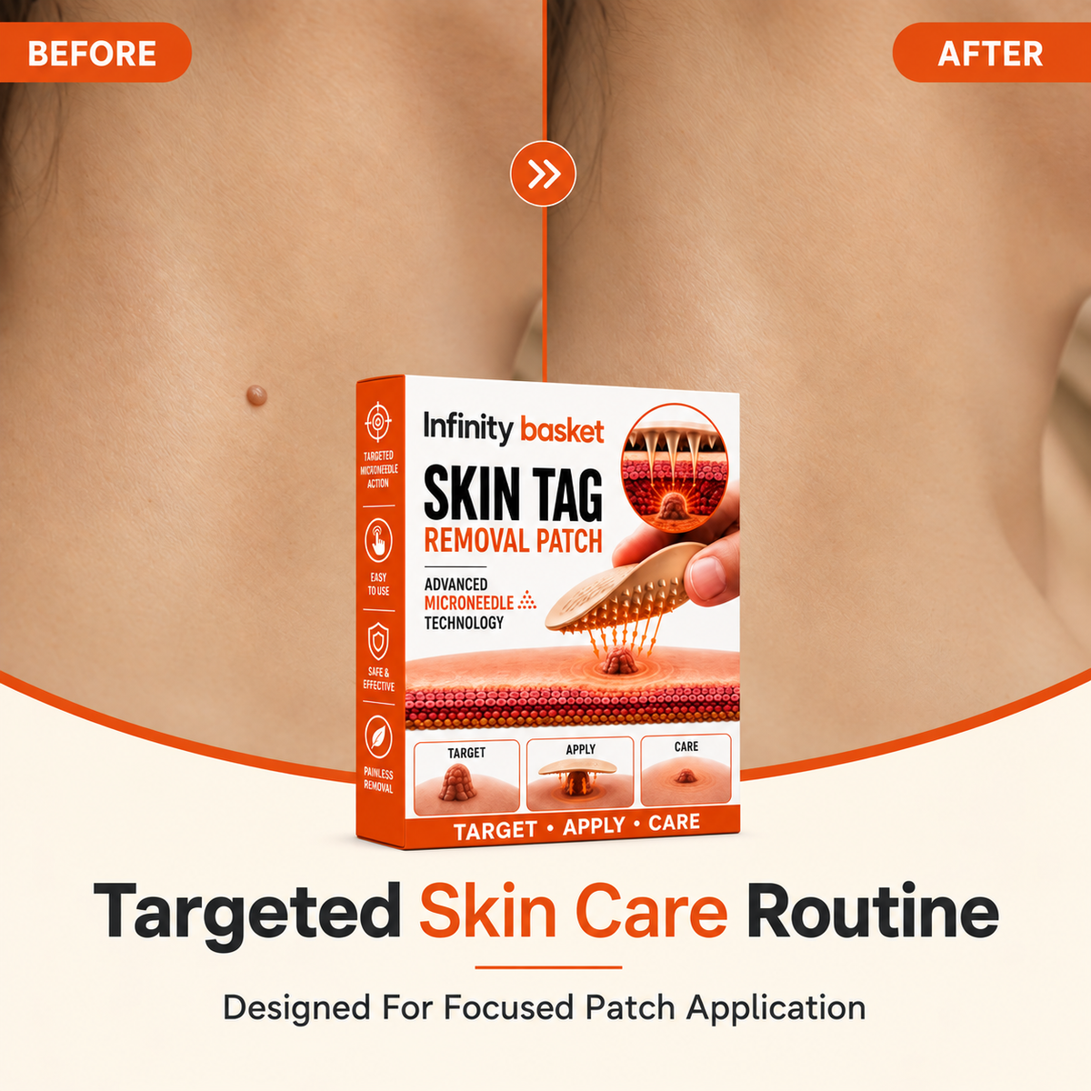 Skin Tag Removal Patch