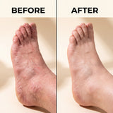 Antifungal Skin Soap