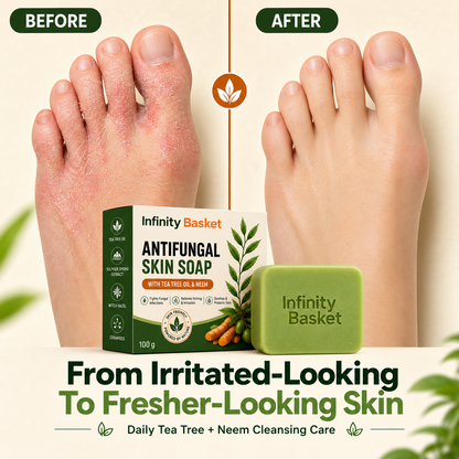 Antifungal Skin Soap